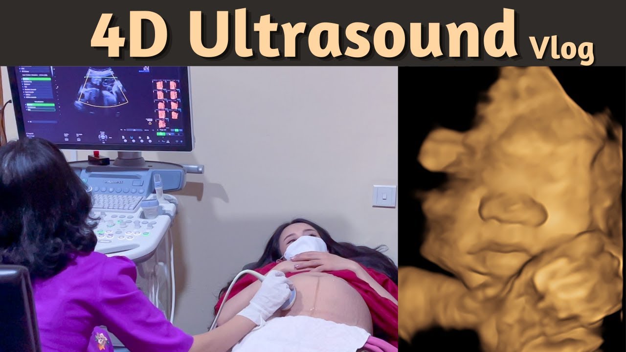4D Ultrasound Vlog