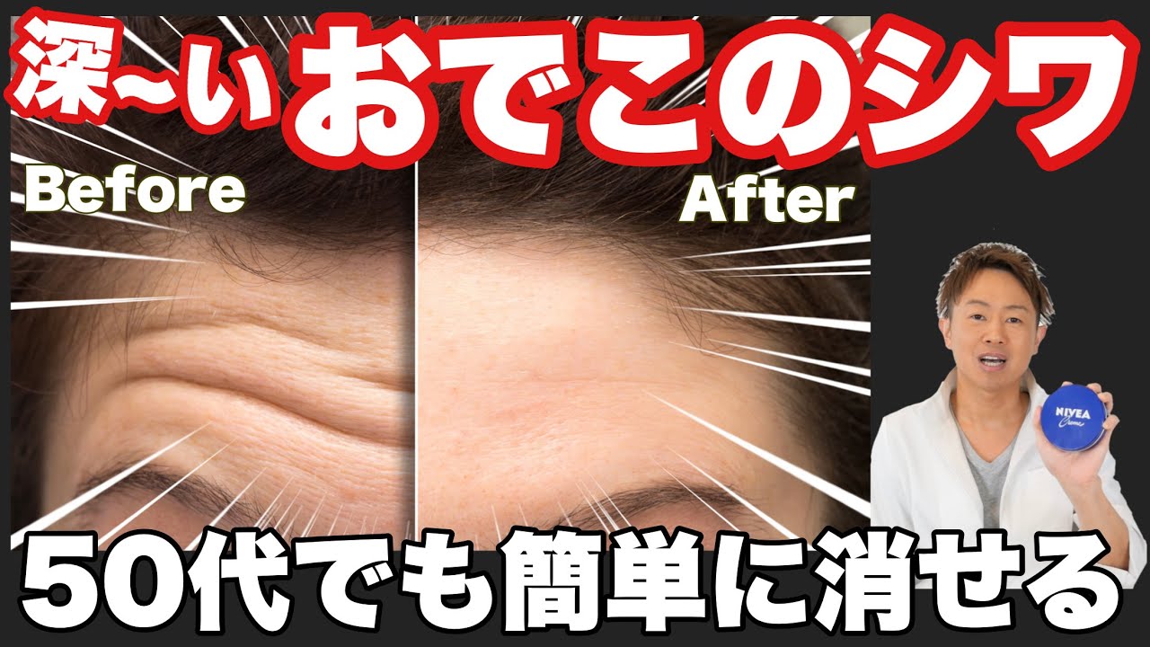 【90秒ニベアマッサージ】深いおでこのしわがこれなら消せます！