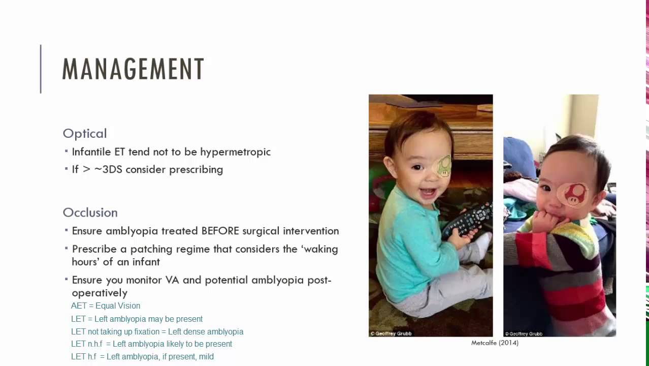 Infantile Esotropia Management