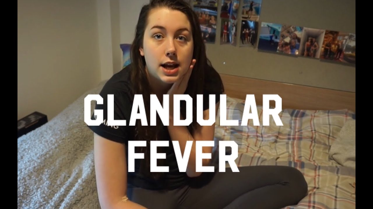 GLANDULAR FEVER 101 | What I'm doing to recover quickly