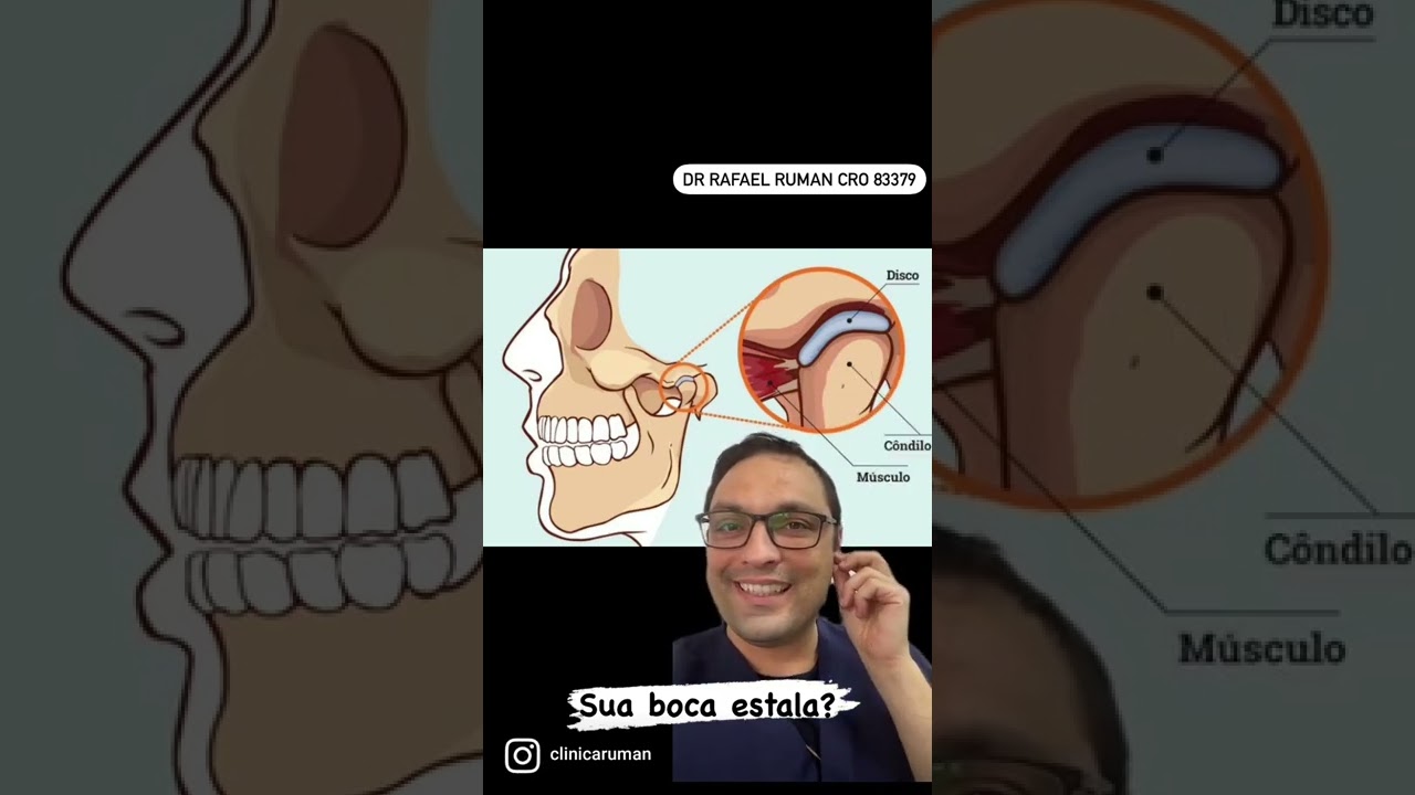 Mand&iacute;bula estalando e doendo.