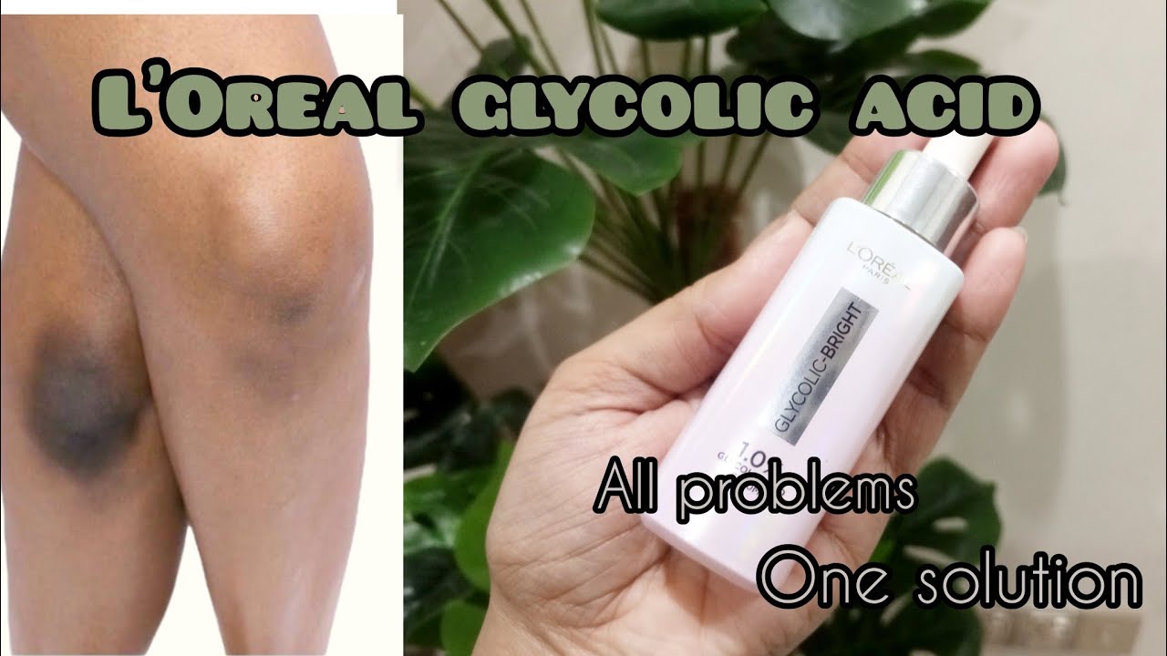 L’Oréal Glycolic Acid Serum Review | Dark Spots & Pigmentation Solution