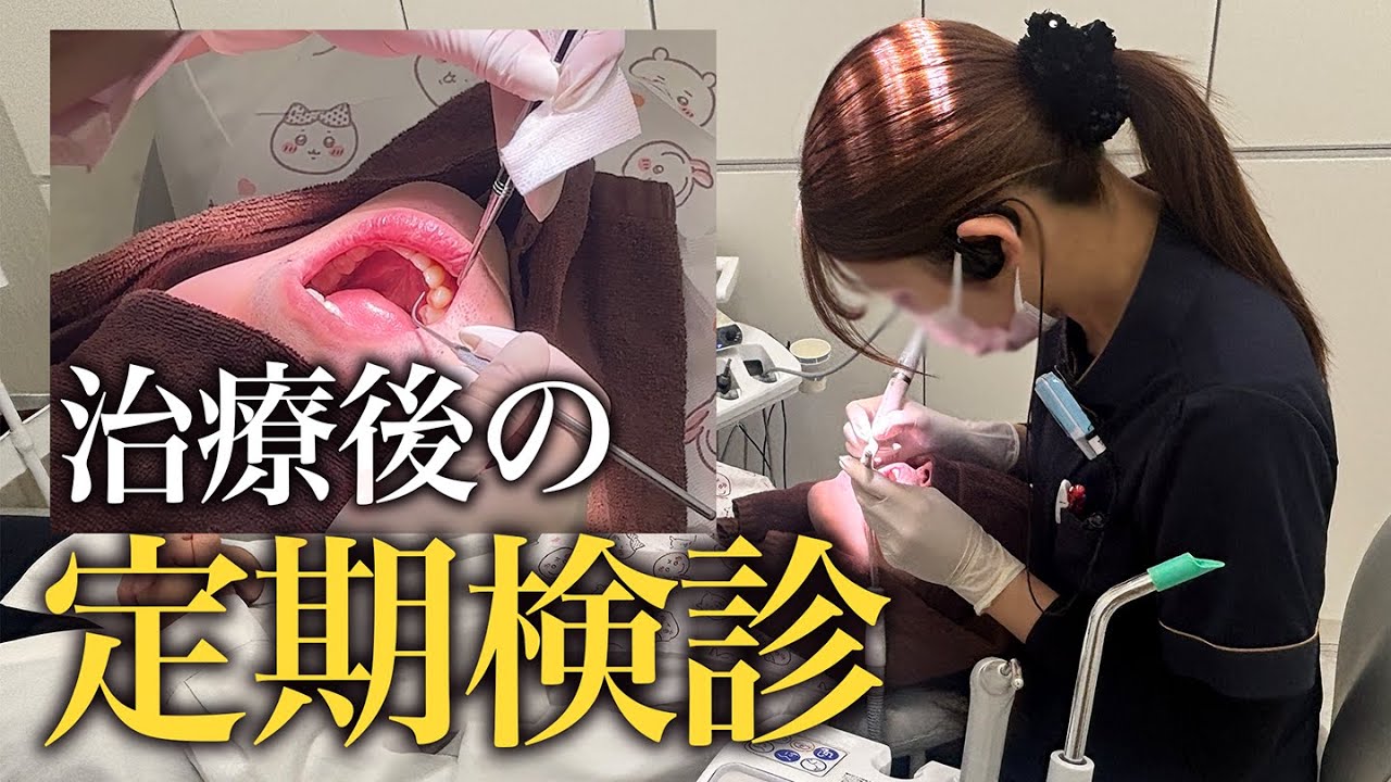 根管治療後の定期検診の様子をお届け！【ワイズ歯科矯正歯科＋KIDSイオン小牧店】