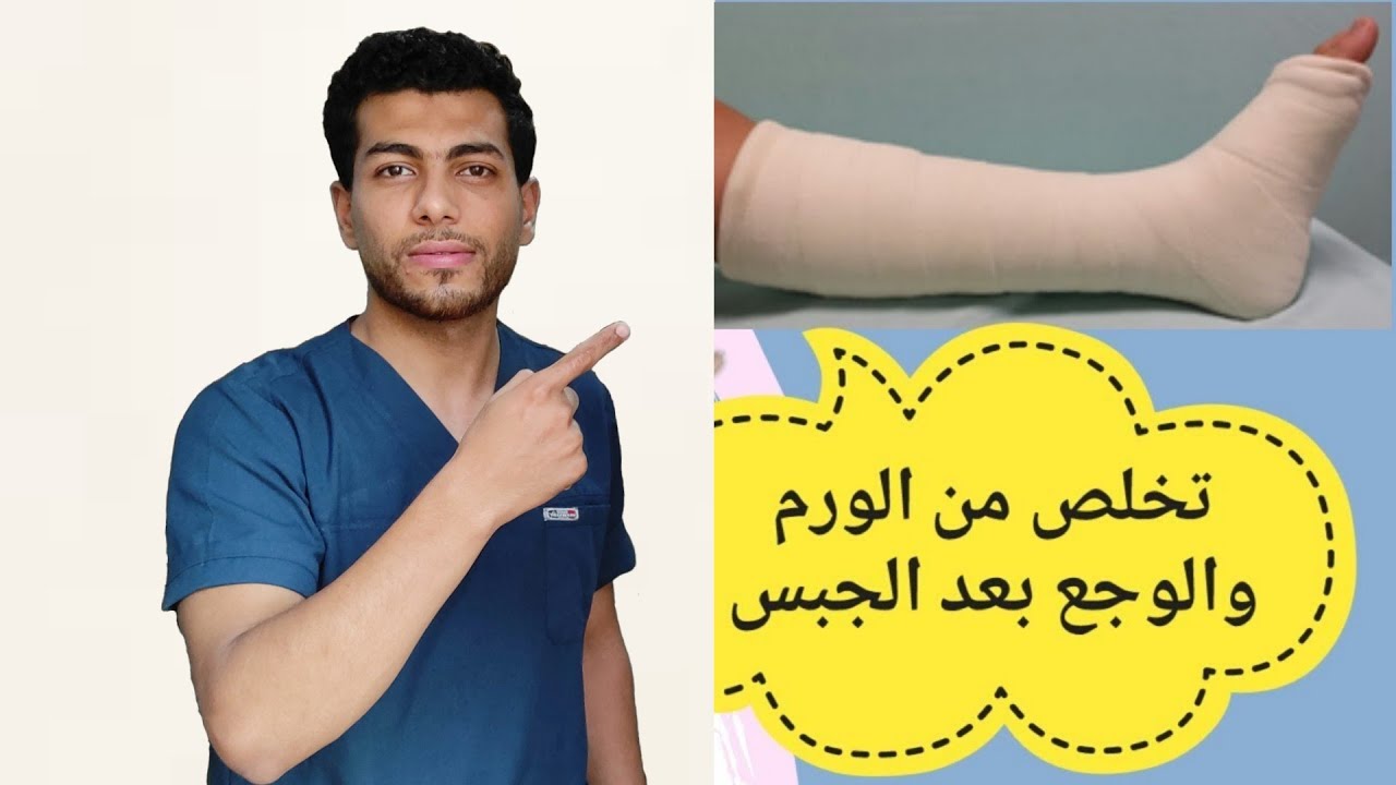 علاج الوجع والورم بعد ازالة جبس القدم-وافضل علاج للتخلص من تيبس القدمين