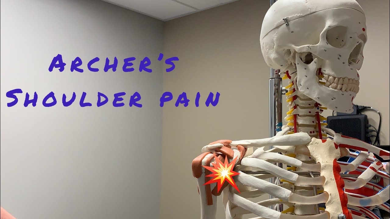 Why does my shoulder hurt after shooting a bow? | Biceps Tendonitis and Hunting