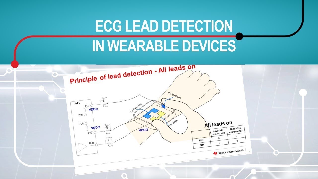 Electrocardiogram (ECG) lead detection in wearable devices