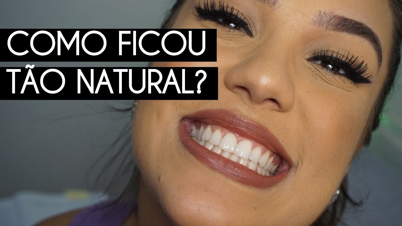 O QUE FIZ NOS MEUS DENTES? Não foi lente! | #VEDA4
