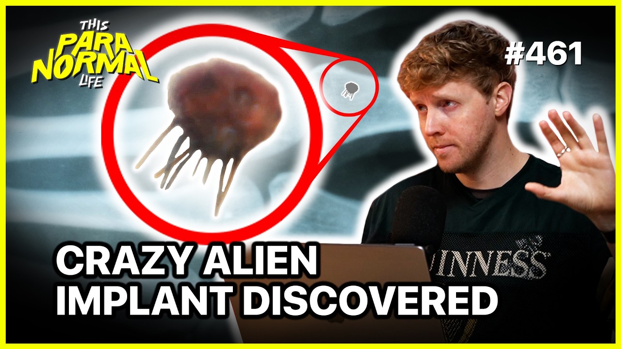 Man Discovers Strange Alien Implant in His Arm