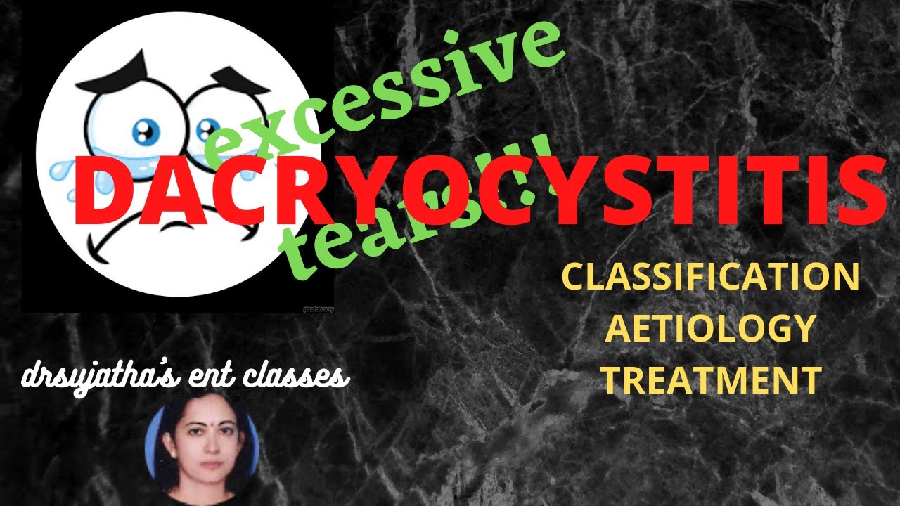 153.Dacryocystitis  #Endoscopic DCR surgery #epiphora #wateringeye