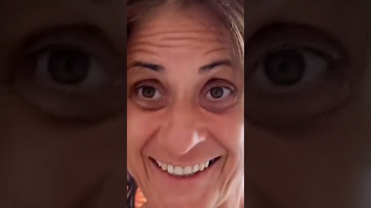 20+ Years Vegan - Dark Eye Circles From Hell #shorts