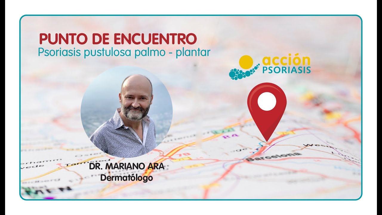 Punto de Encuentro: Psoriasis Palmoplantar | Con el doctor Mariano Ara, dermatólogo