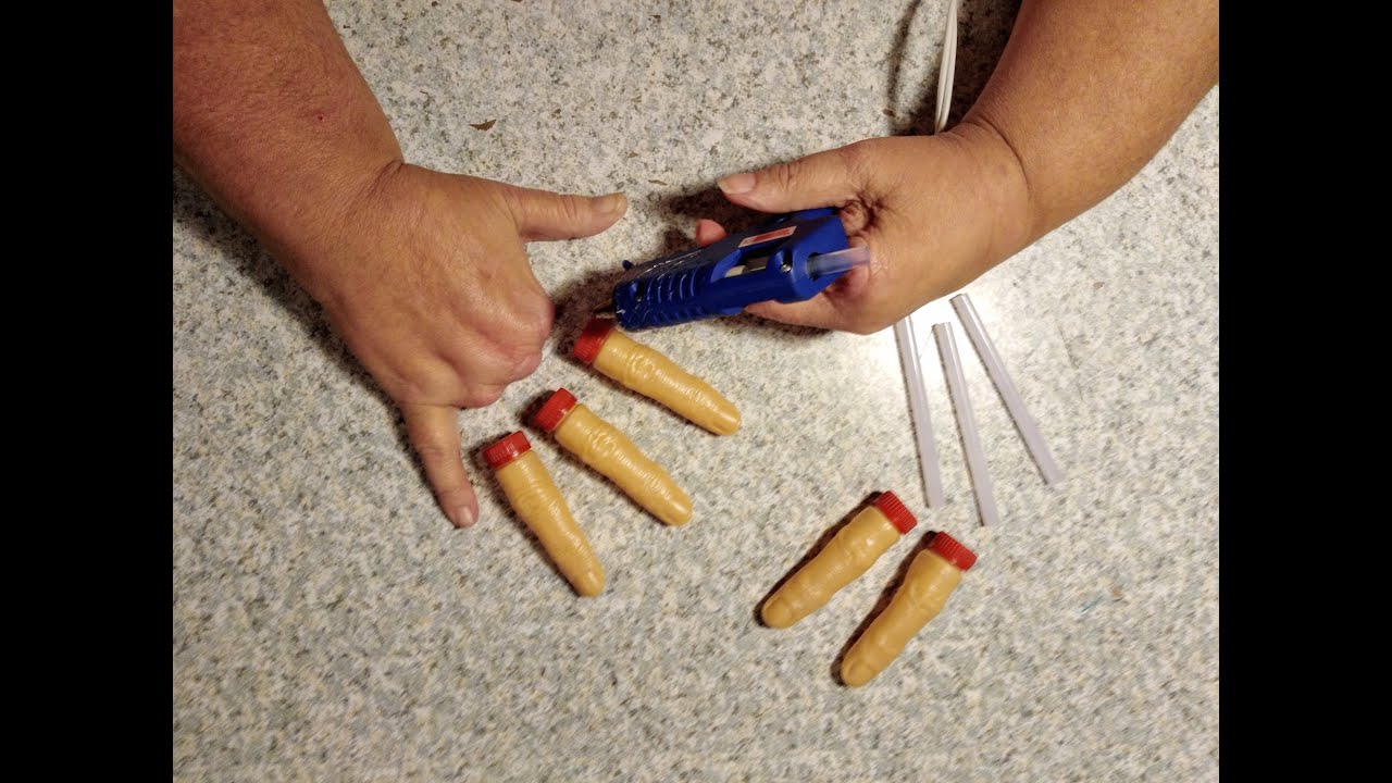 What Happened to my Fingers? * Finger Amputations * Raynaud's