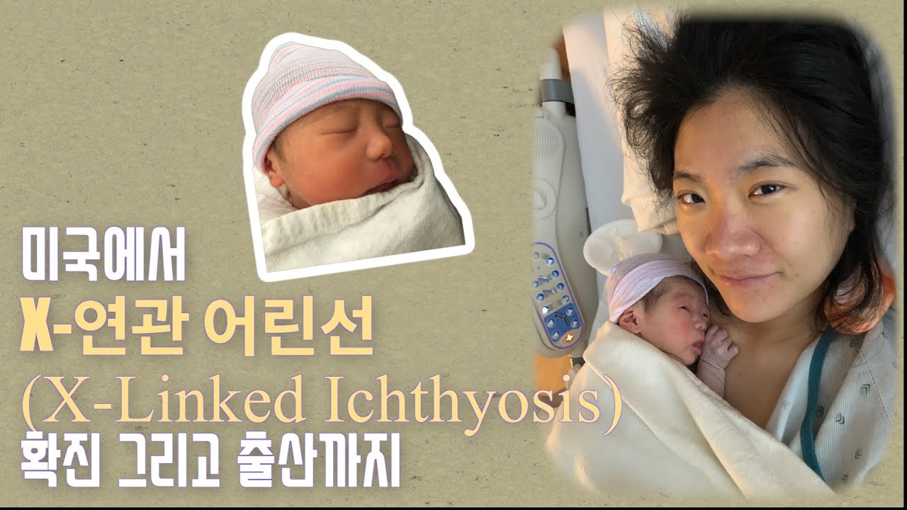 EP1. 미국에서 X-연관 어린선(XLI) 확진 후, 코로나 시기 출산까지 (2022 기록) XLI Diagnosis to Delivery (US)