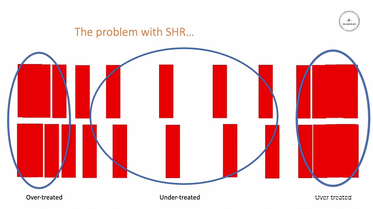 SHR - how good is it?