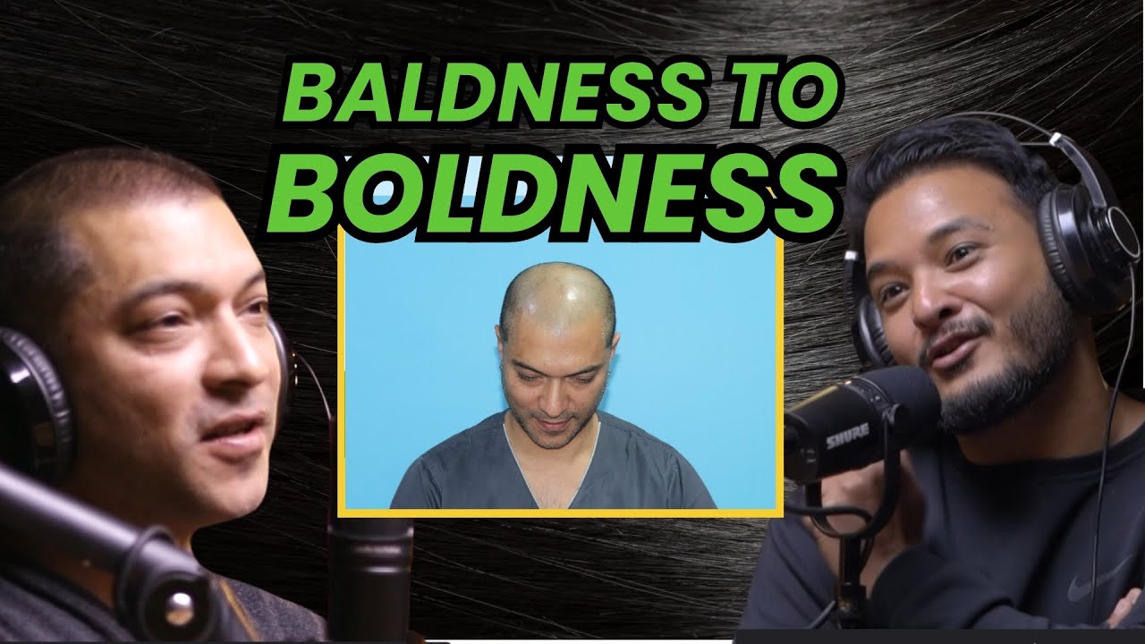 Sushil Nepal's Shares His Hair Transplant Journey | Dr. Pramod Agarwal | Sushant Pradhan Podcast