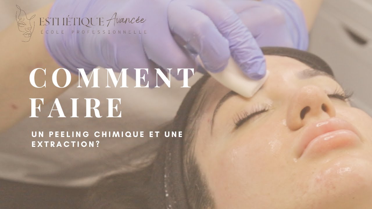 Comment faire un Peeling Chimique et une Extraction : Notre Guide Complet !