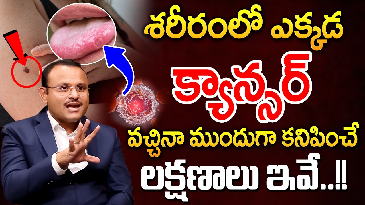 శరీరంలో ఎక్కడ క్యాన్సర్ వచ్చినా ముందుగా కనిపించే లక్షణాలు ఇవే.! | Cancer Symptoms | Suresh | iDream