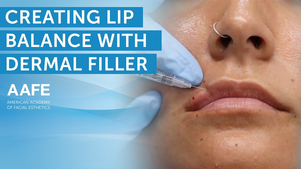 Балансировка губ с помощью дермального филлера Top Lip Only | AAFE