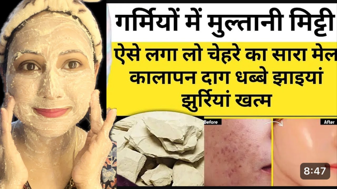 मुलतानी मिट्टी में सिर्फ़ 1चीज मिलकर लगाने से चमक गया मेरा चेहरा |full body whitening face pack 👈🏻