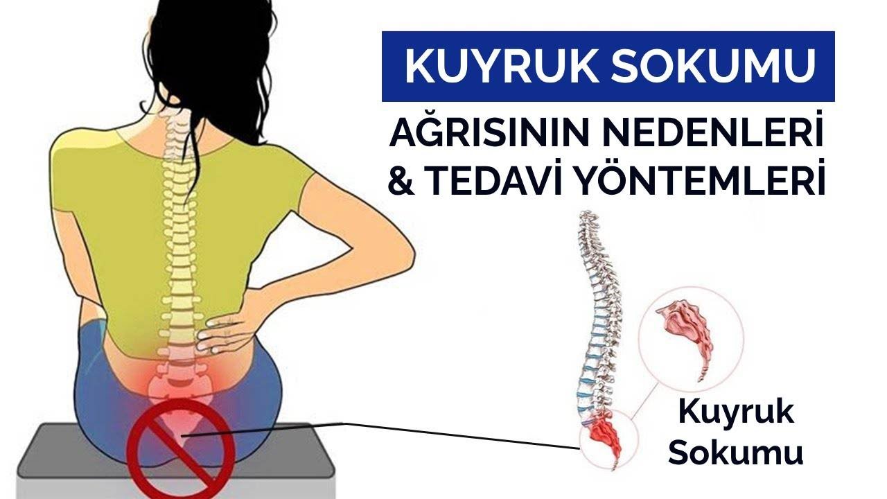 Kuyruk sokumu ağrısının nedenleri ve tedavi yöntemleri nelerdir? | Prof. Dr. Yakup YILDIRIM