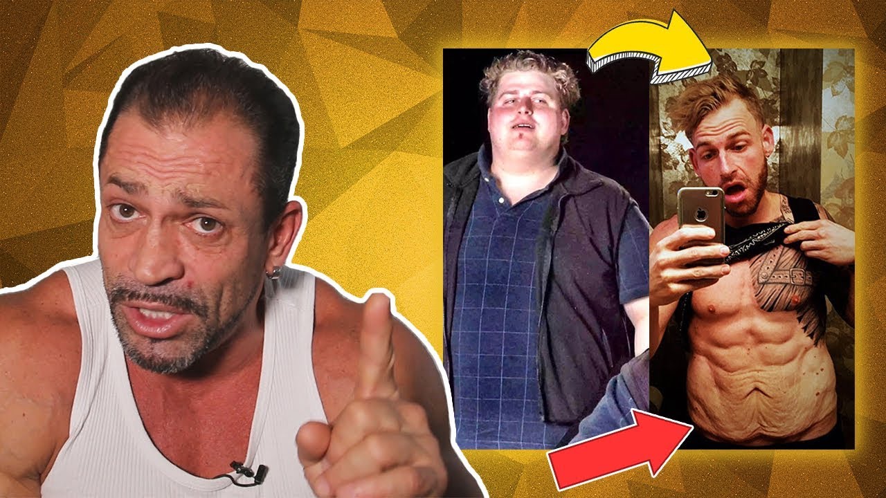 Emagreci 30kg mas fiquei com a pele FL&Aacute;CIDA e com ESTRIA | O que fazer?