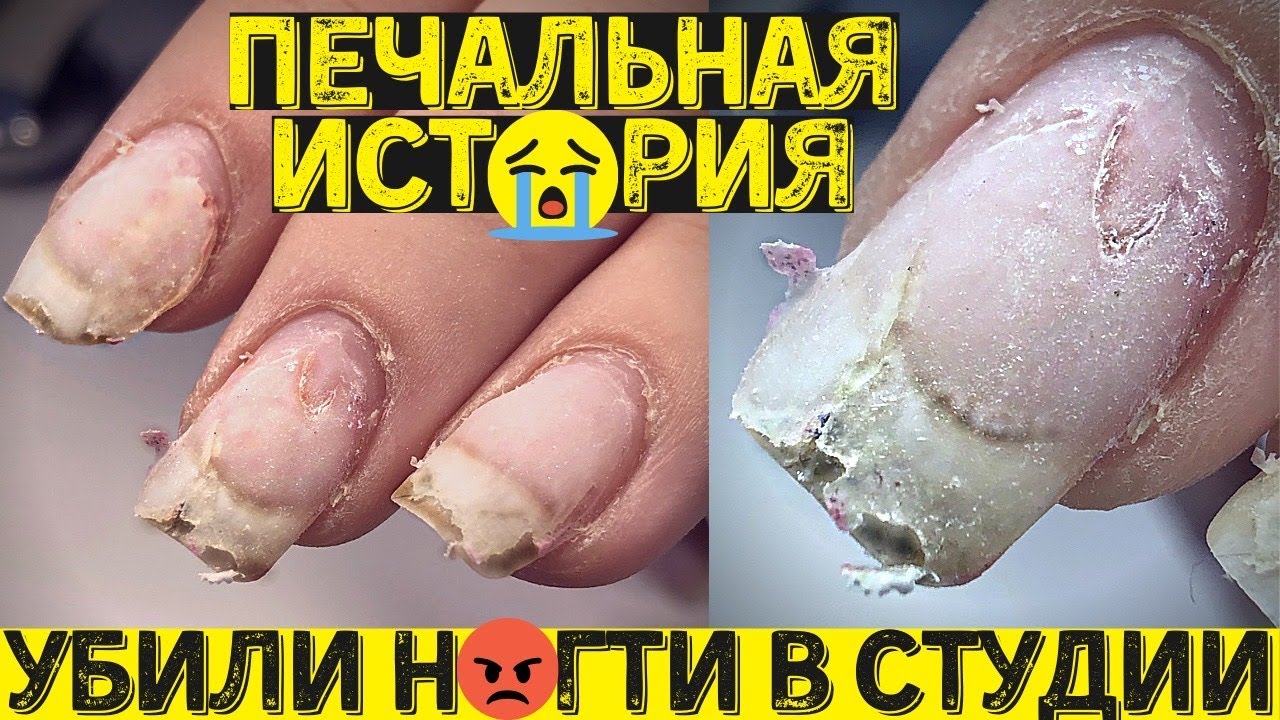Чем ОПАСНО перенашивать гель лак? Маникюр и дизайн ногтей