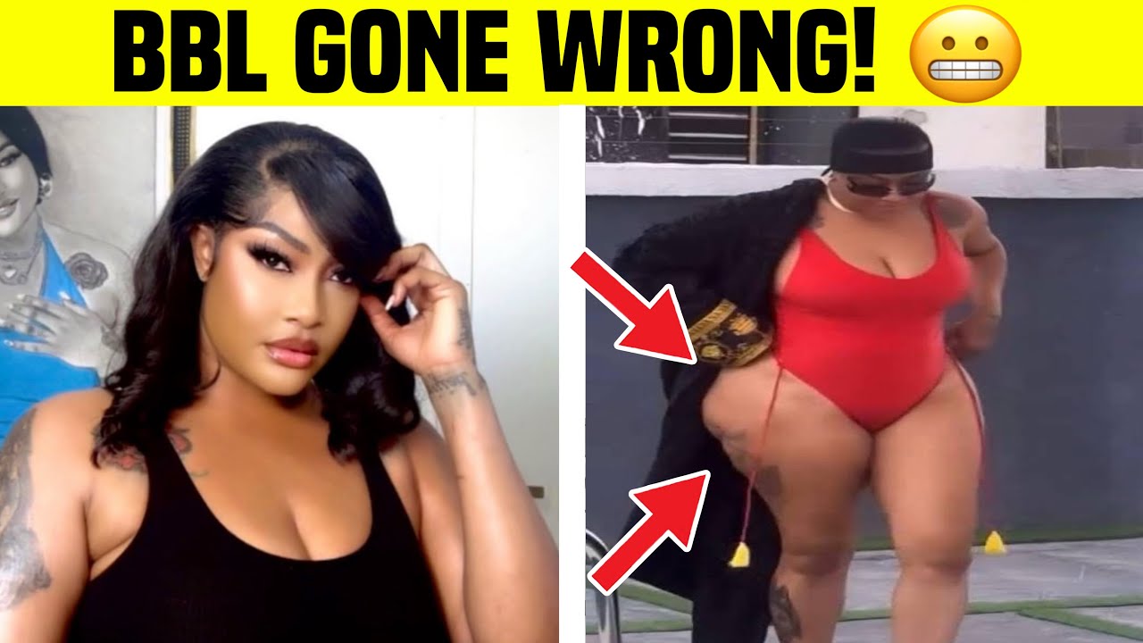 Nigerian Celebrity BBL Gone Wrong! (No1 Will Make You Vormit)