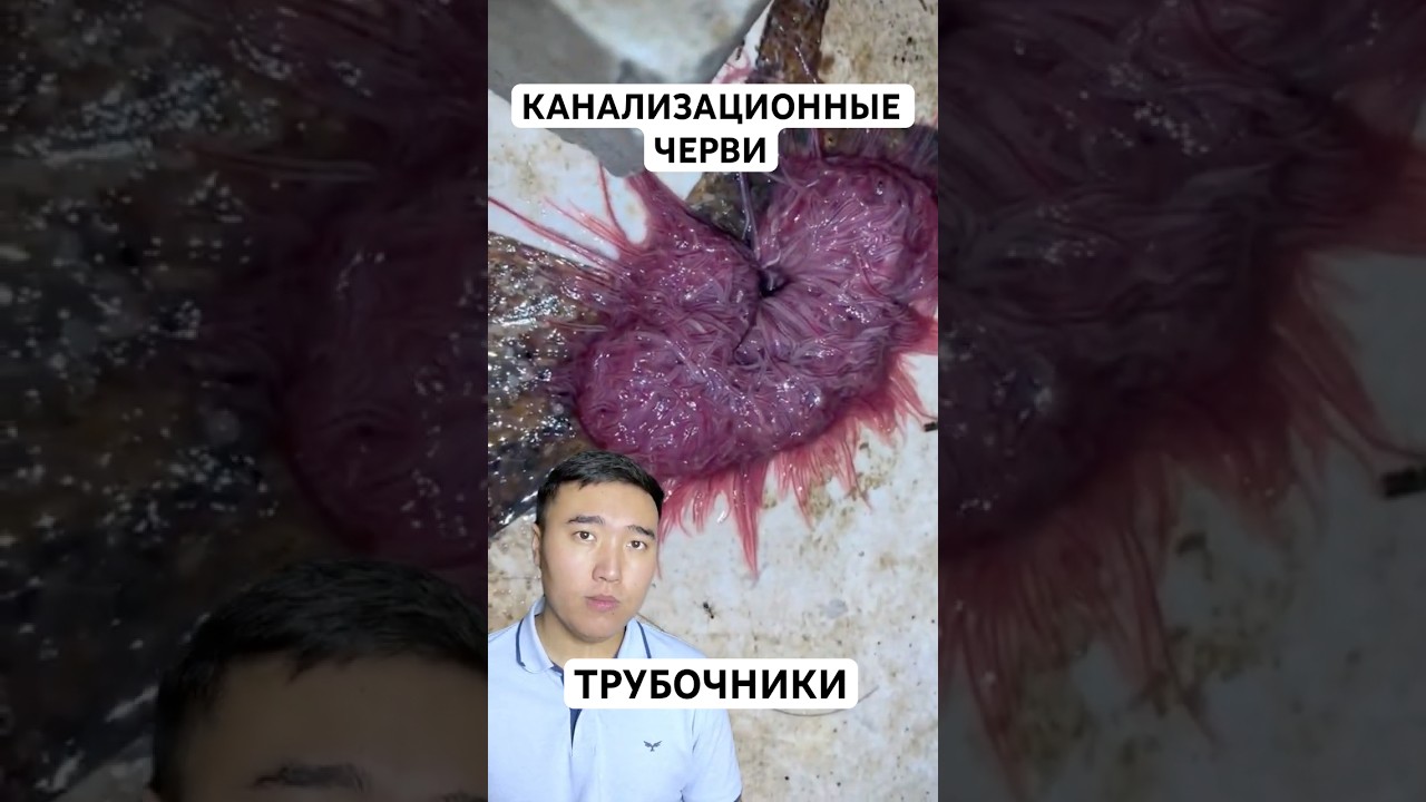 Почему Эти Черви Живут в Сточных Водах