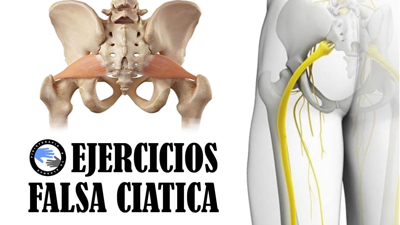 Los 3 mejores ejercicios para tratar el sindrome del piramidal o falsa ciatica