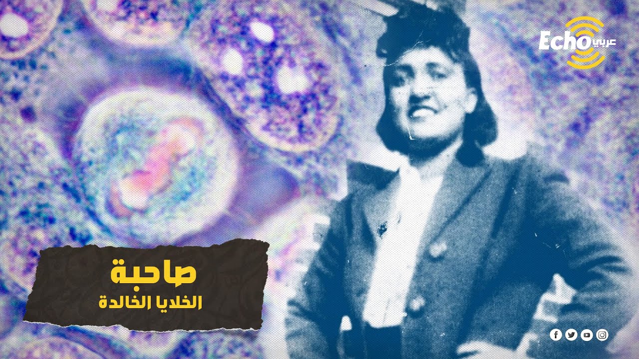 هنريتا لاكس.. ماتت منذ 70 عامًا وتركت جزءًا منها حيًا حتى الآن ساهم في انقاذ ملايين البشر