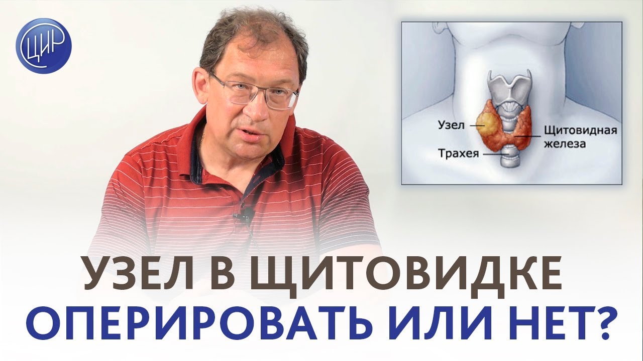 Узел в щитовидке. ДЕЛАТЬ ЛИ ОПЕРАЦИЮ? Отвечает Гузов И.И.