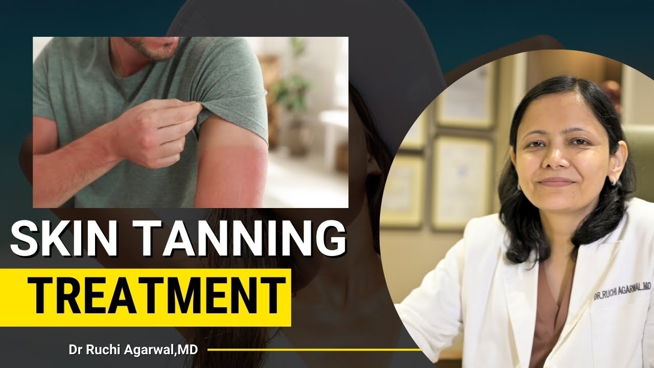 Skin tanning | Skin tan removal laser treatment | Skin tanning treatment | Skin tan&nbsp;removal&nbsp;|&nbsp;Satya