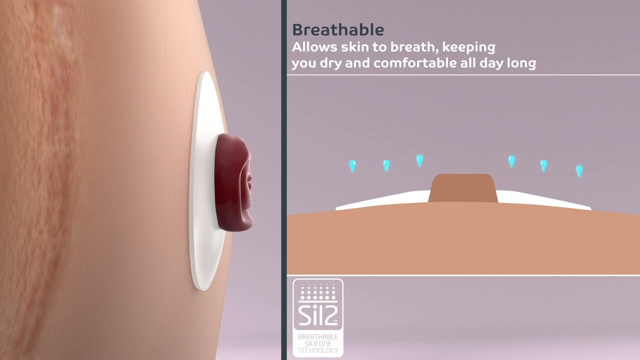 Genii™ Ostomy Seal - How to Guide