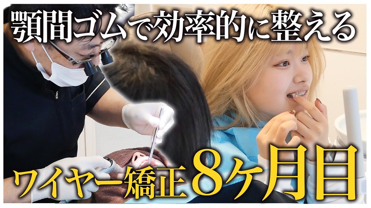 【治療8ヶ月】顎間ゴムで整えていく🦷ワイヤー矯正の調整風景に密着【名古屋ルミナス歯科・矯正歯科】