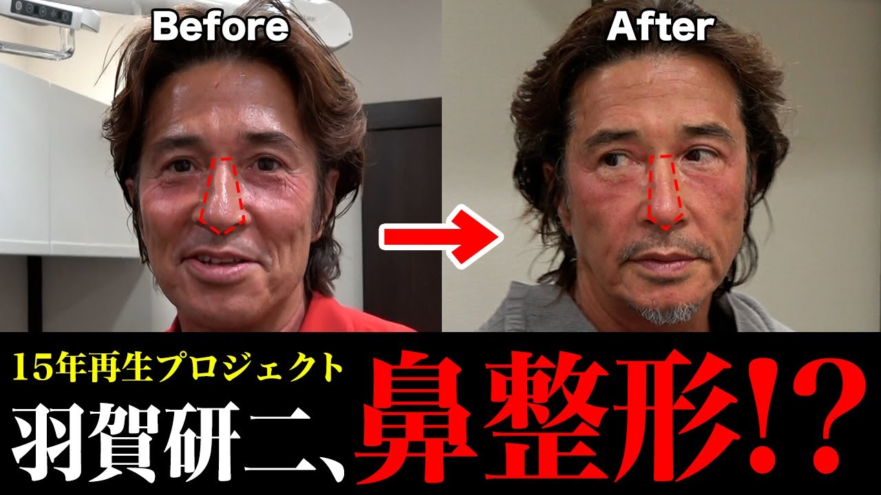 今話題のポテンツァや痛みの少ないヒアルロン酸注入などエイジングケア治療盛り沢山！