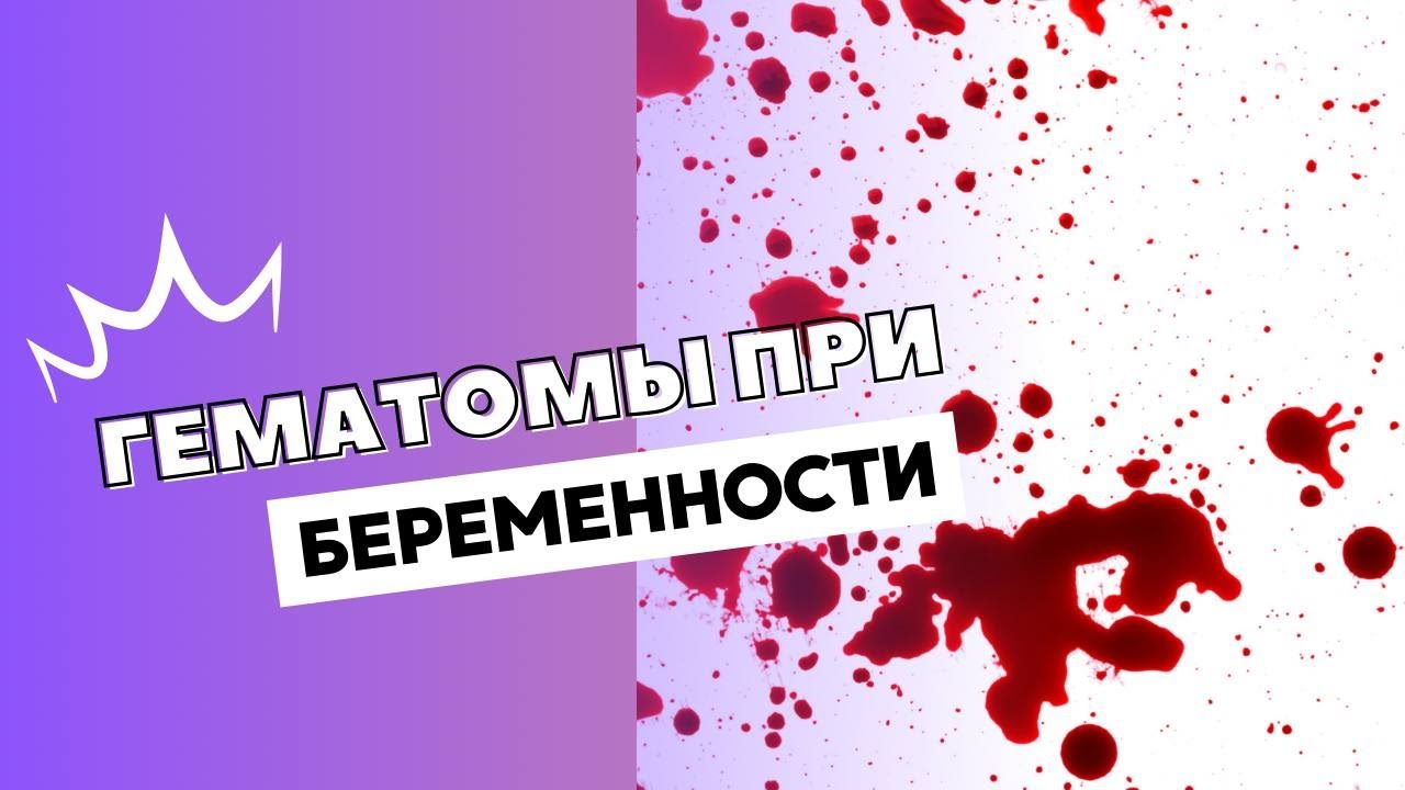 ГЕМАТОМЫ ПРИ БЕРЕМЕННОСТИ #olenaberezovska #doctorberezovska #беременность #гематомы #прогестерон
