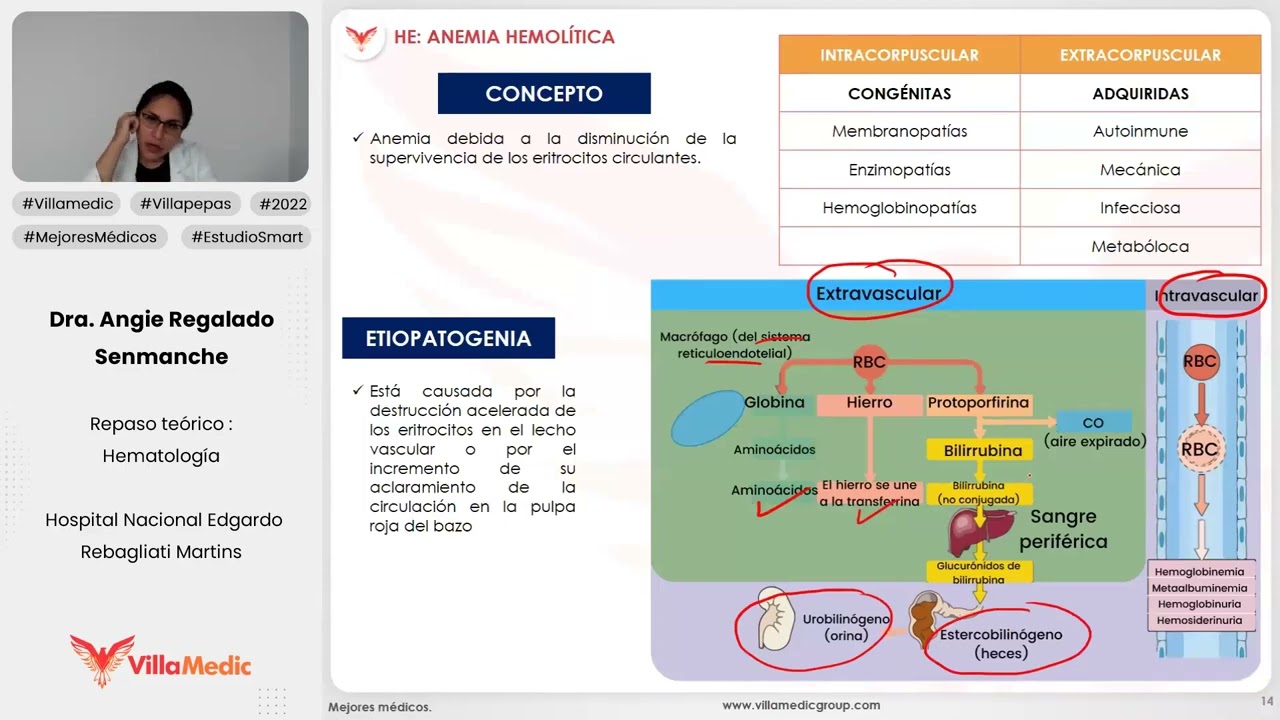 ANEMIA HEMOLÍTICA - HEMATOLOGÍA - VILLAMEDIC