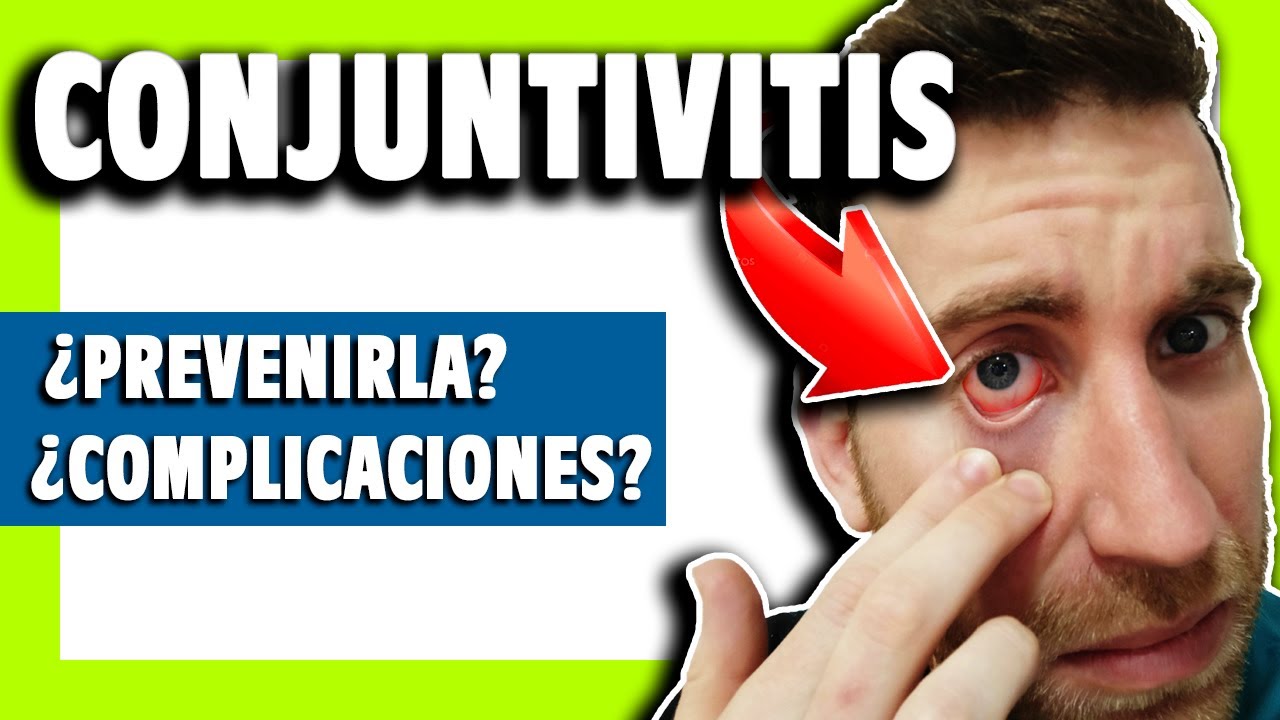 ▶️ &iquest;Qu&eacute; es la CONJUNTIVITIS del OJO? Signos y s&iacute;ntomas [Cap&iacute;tulo #1]