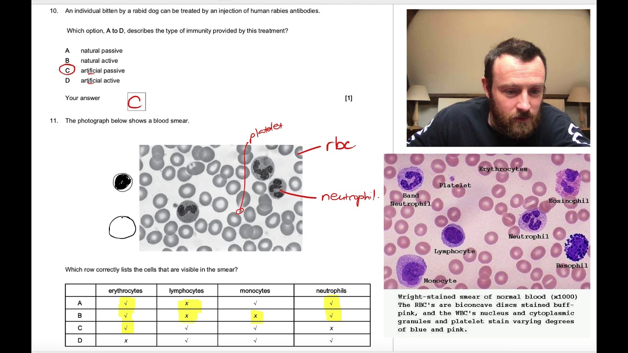 Disease Multiple Choice Questions (OCR A Level Biology 4.1)
