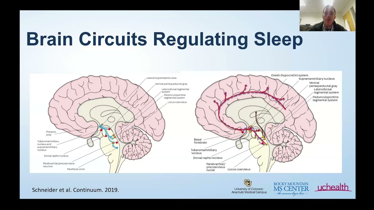 Virtual Education Session: Sleep, MS, and Your Brain