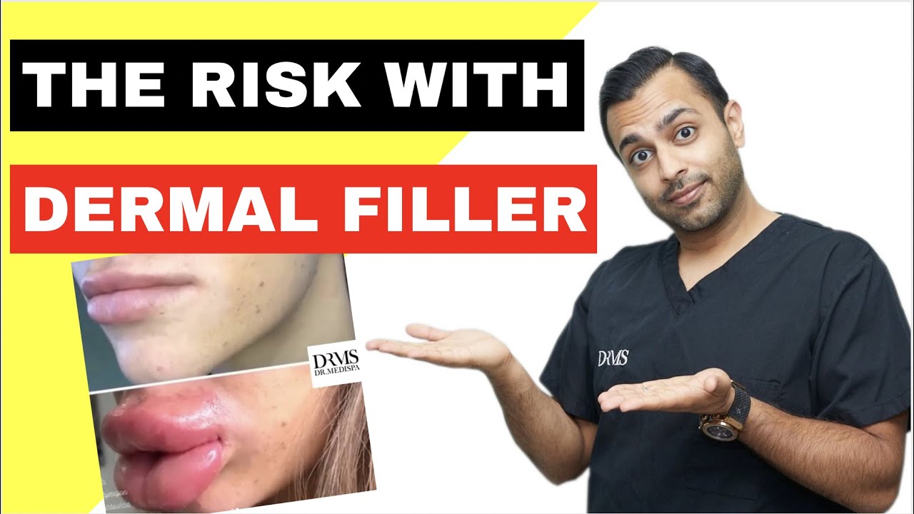 What are the RISKS of Dermal Filler?