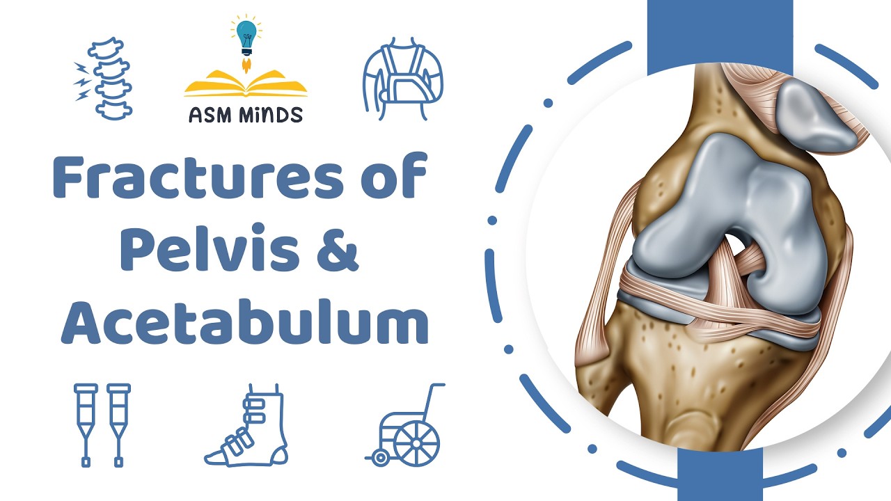 17 - Fractures of Pelvis & Acetabulum - Orthopedics Course - By Dr.Sofy Said