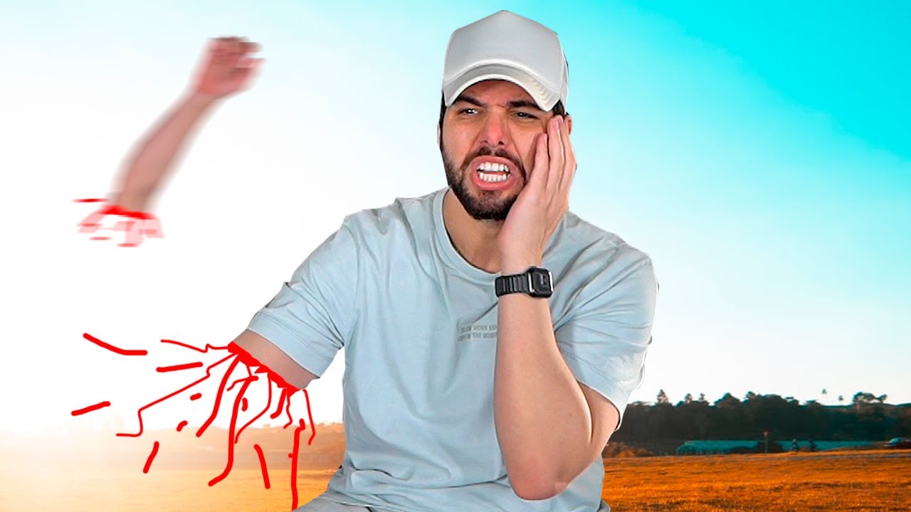 Era pra ser um v&iacute;deo normal, mas acabei perdendo o bra&ccedil;o