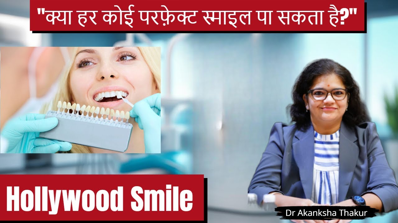 Can You Get A PERFECT Hollywood Smile in just 1 Week?| हॉलीवुड स्माइल