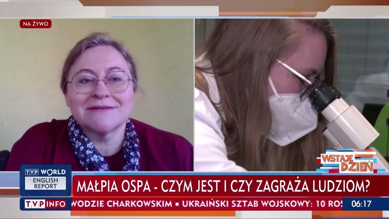 Małpia ospa - czym jest i czy zagraża ludziom? Dr n. med. Iwona Paradowska-Stankiewicz w TVP Info