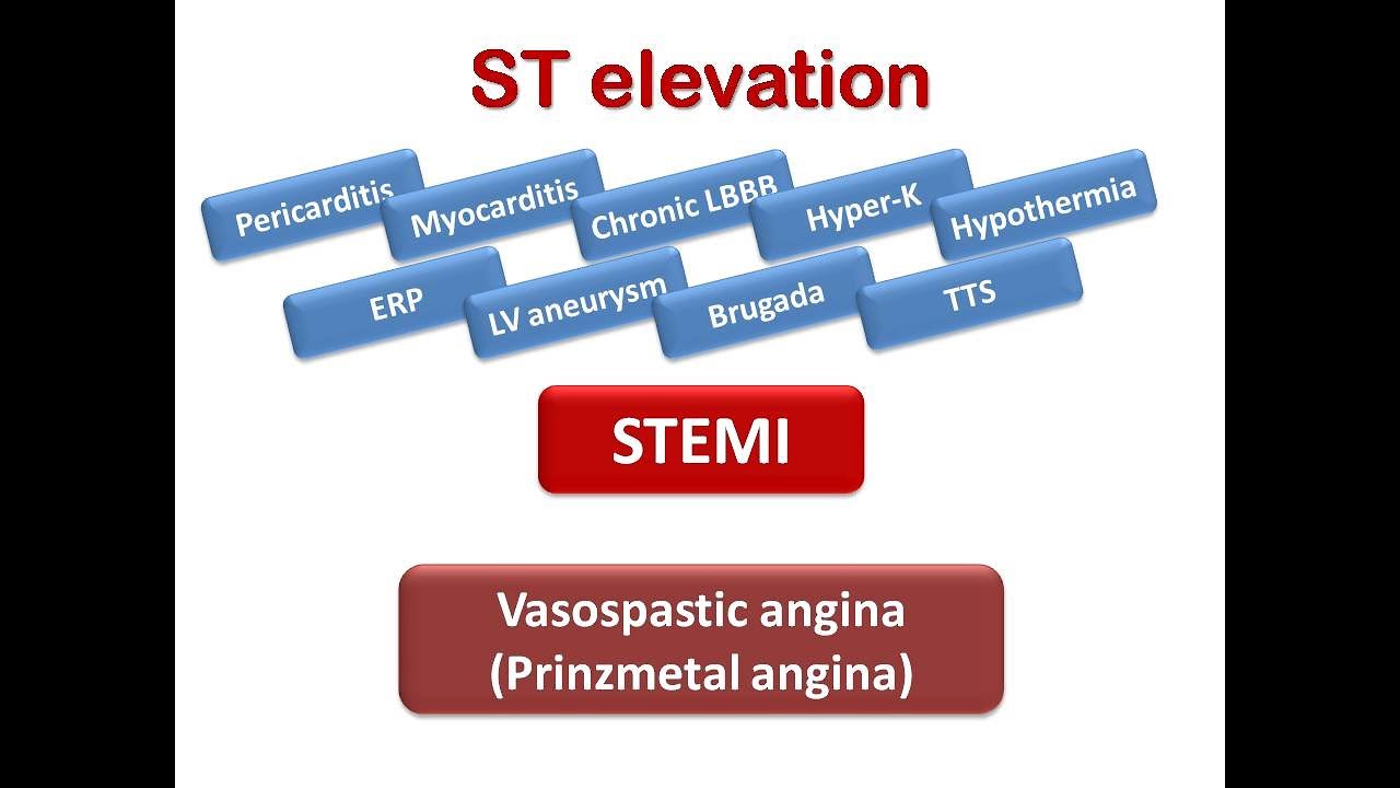 ECG course: ST segment elevation (STEMI & others), Dr. Sherif Altoukhy
