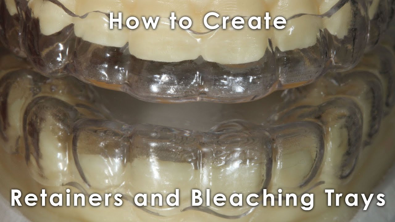 How to Create Retainers and Bleaching Trays