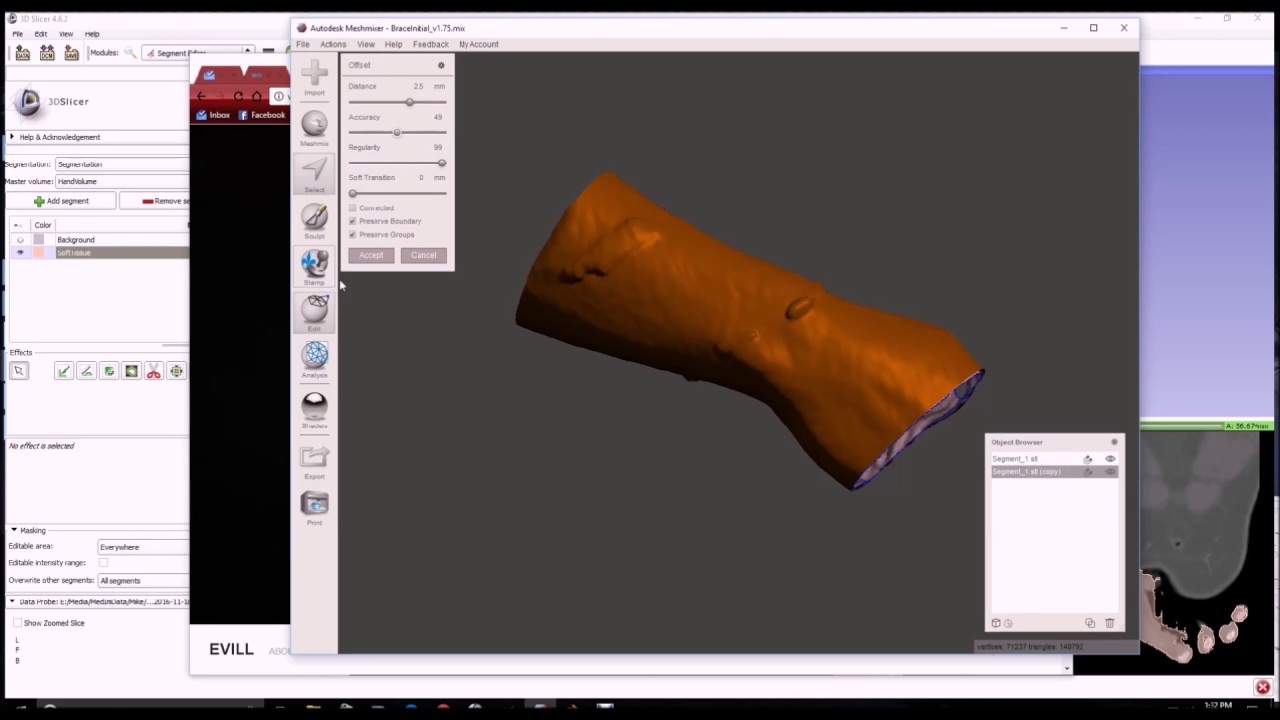 3D Printed Wrist Brace