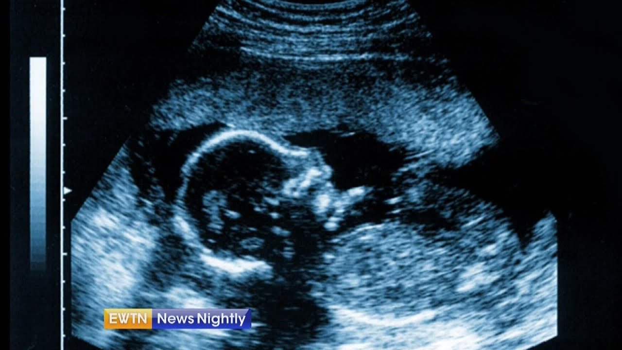 DHS Ends Contract with Company Dealing in Fetal Tissue - ENN 2018-09-25