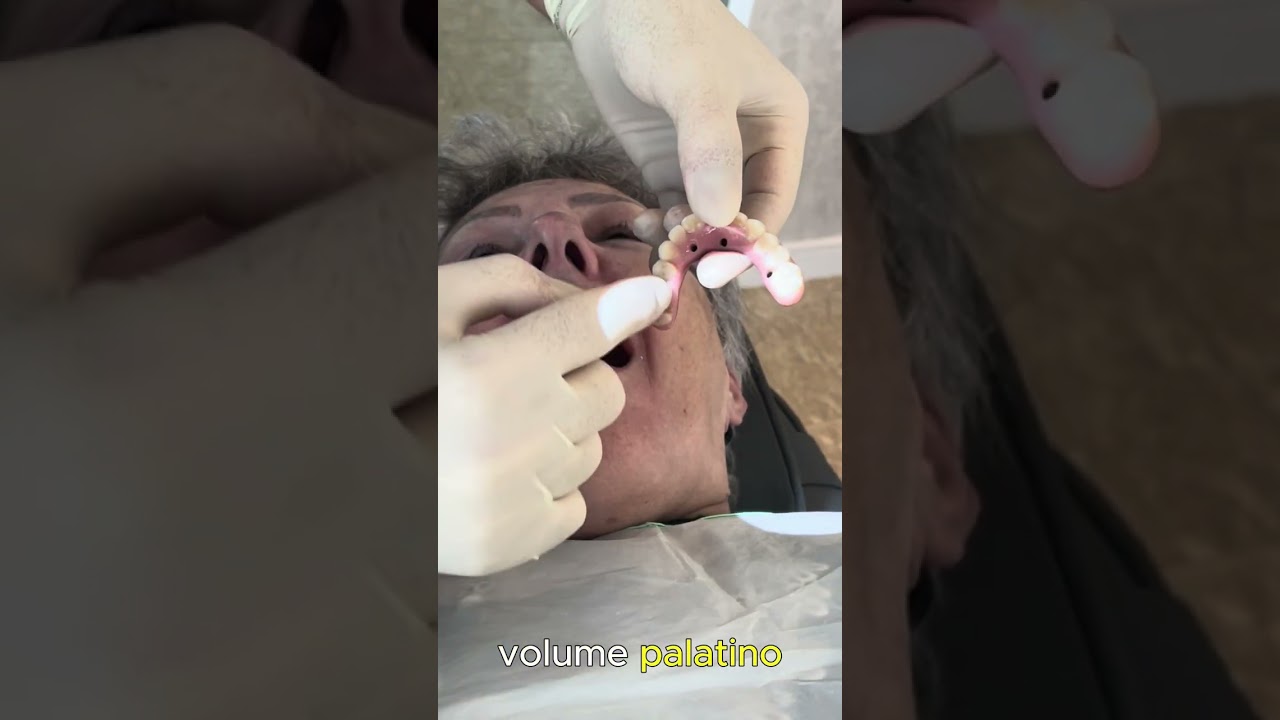 Pr&oacute;tese Protocolo Ao Vivo No Paciente